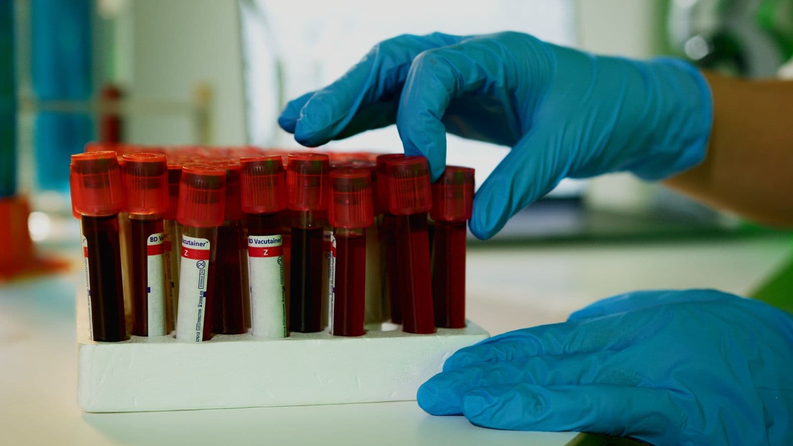 Blood sample vials in a laboratory rack
